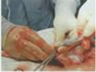 Açıklama: Kordon Kanı