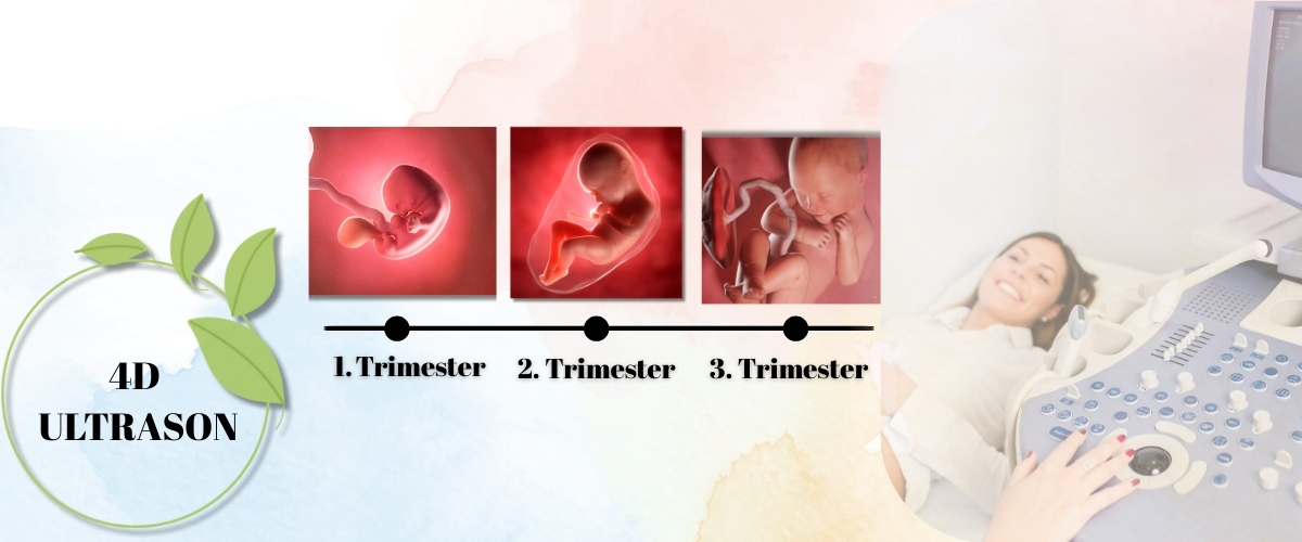 4D Ultrasound